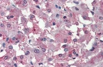 Immunohistochemistry-Paraffin: THEM6 Antibody [NBP3-14494]